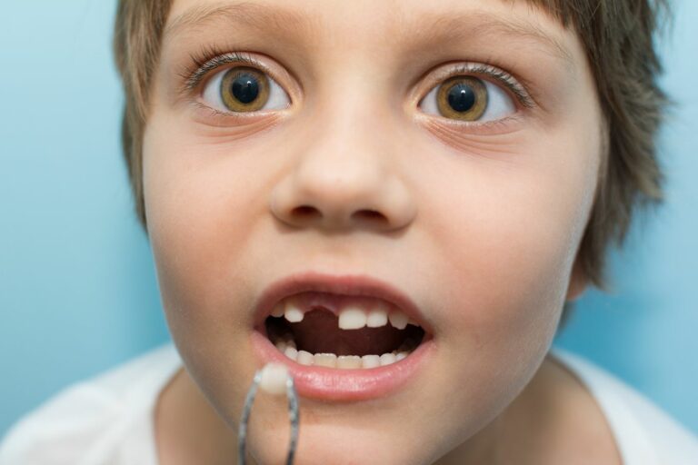 Quelles sont les raisons d'arracher une dent de lait chez le dentiste ?