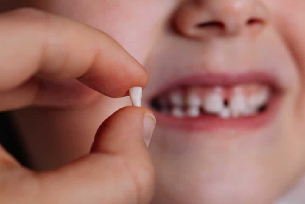 Do baby teeth have roots?