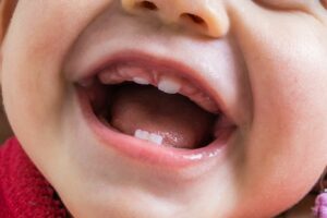 Les dents de bébé sortent à quel âge ?