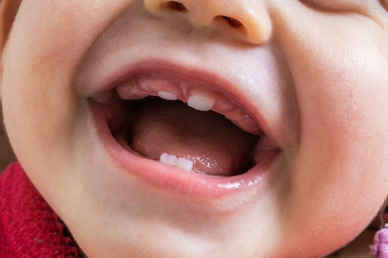Les dents de bébé sortent à quel âge ?