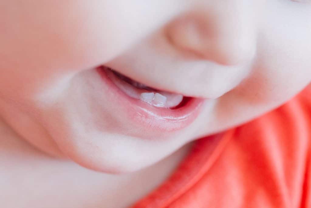 Sourire de bébé dont la première dent a poussé de travers