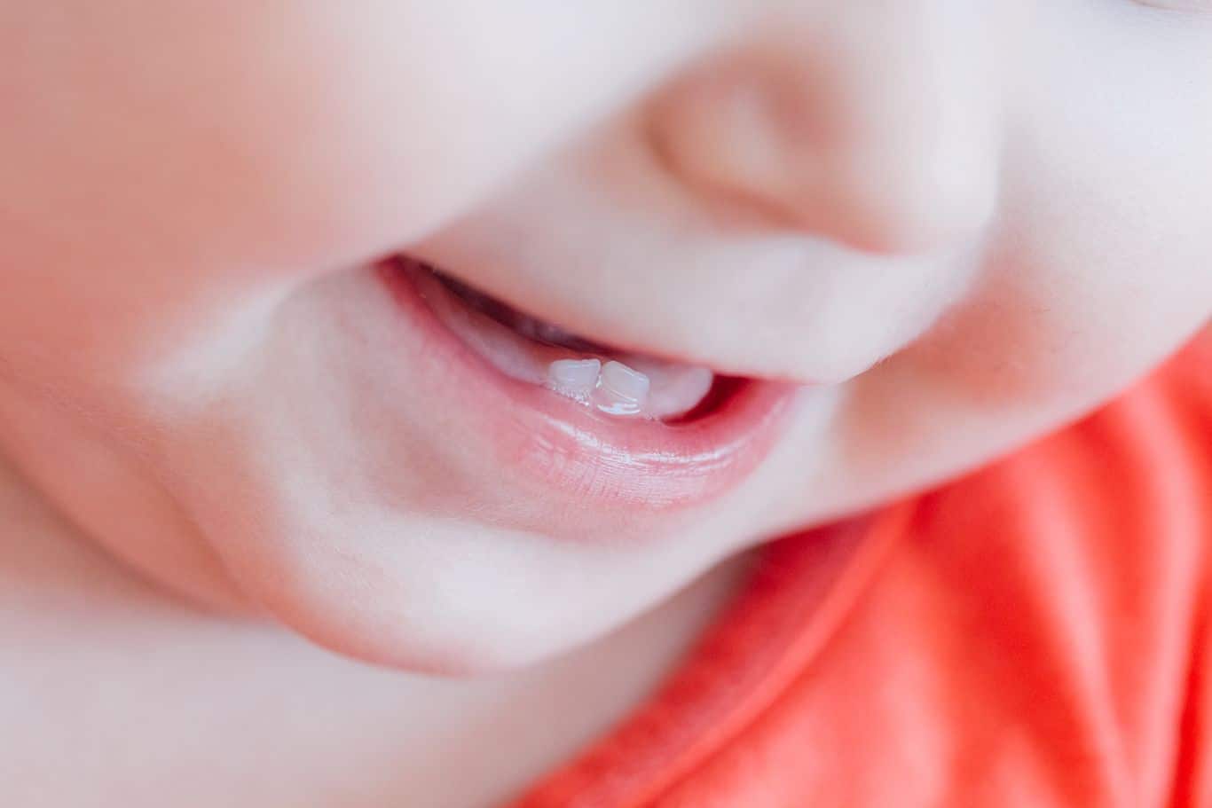 La première dent de bébé est de travers : que faire ? - Dentiste