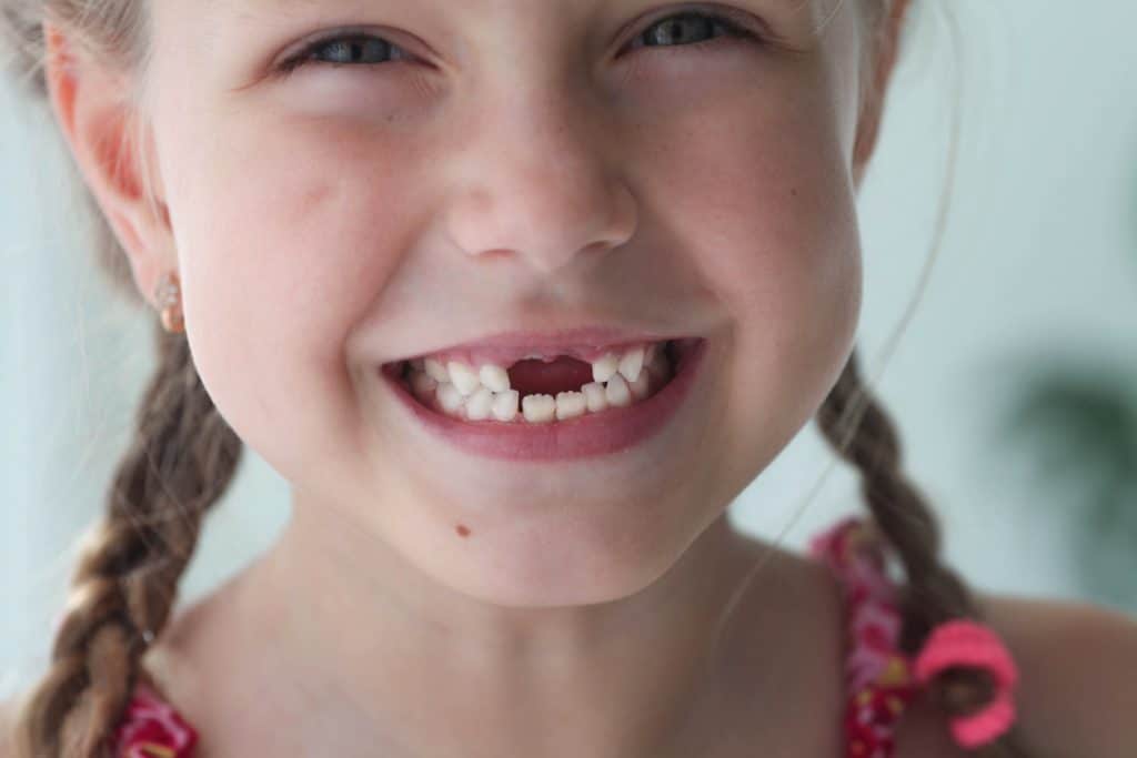 A baby tooth falling out is a milestone for a child.