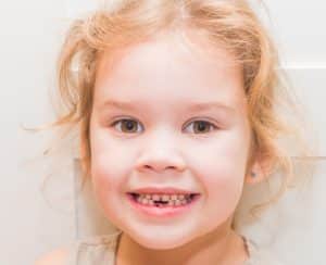 What to do about early loss of baby teeth?