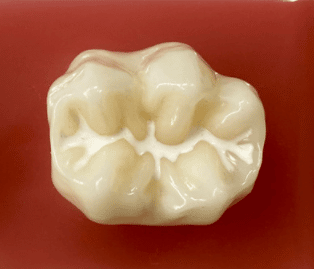 Tutoriel - Comment Protéger les Dentes Contre les Caries - Dentist Enfant
