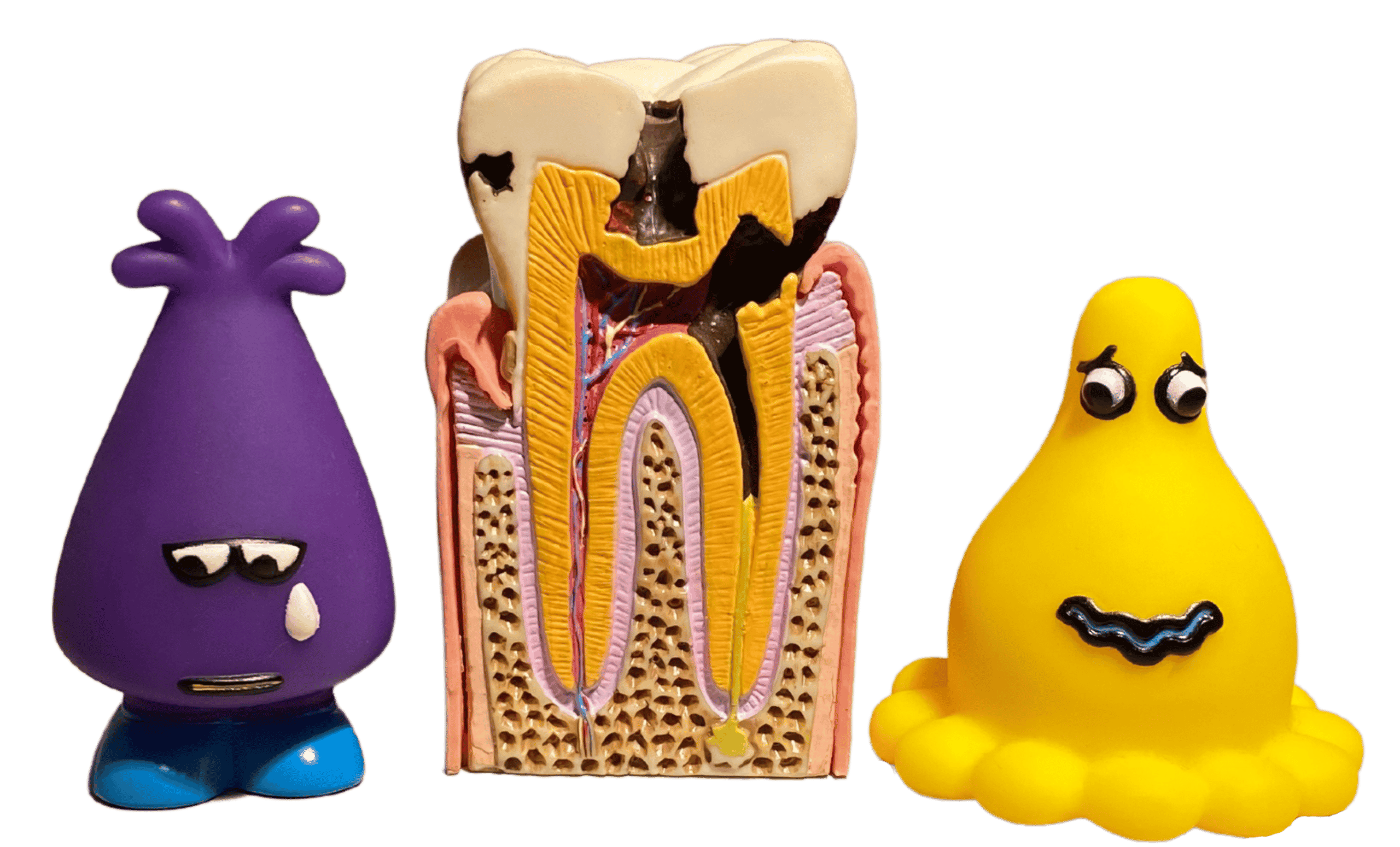 Caries - What is a cavity? - Child Dentist